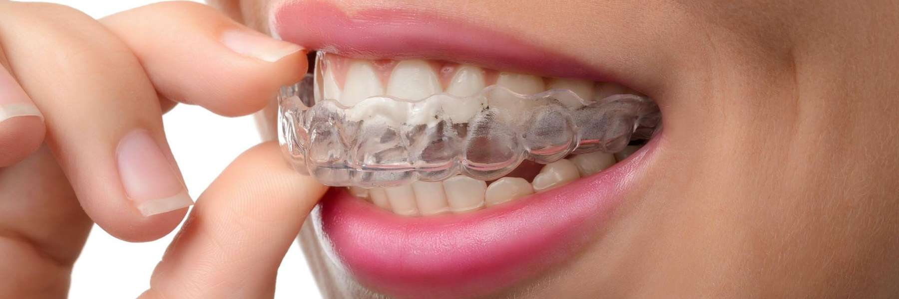 Woman with pink lips wearing her transparent Invisalign in Kentucky