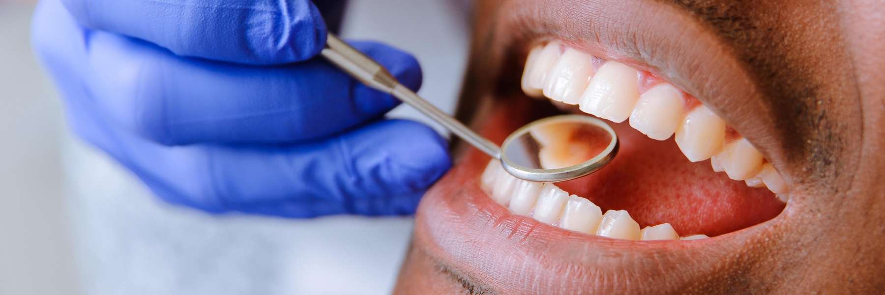 A man getting a dental checkup | dental cleanings in Winchester